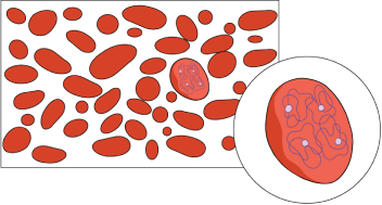 Graphic showing how normal red blood cells look with healthy levels of hemoglobin